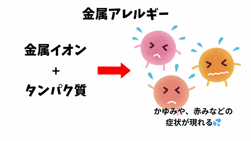 金属アレルギーの仕組み